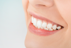Gum Contouring Using Laser