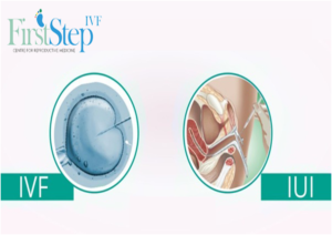 IVF VERSUS IUI
