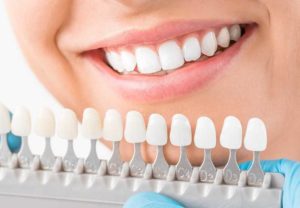 Opting For Teeth Whitening- Visit a Dental Clinic Today