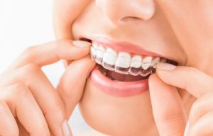 https://www.thelys.org/cosmetic-dentistry-behind-the-face-mask-for-now/