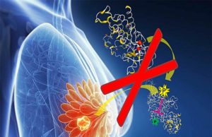 Dr. Paolo Boffetta - An Overview of the 5 Common Types of Cancer