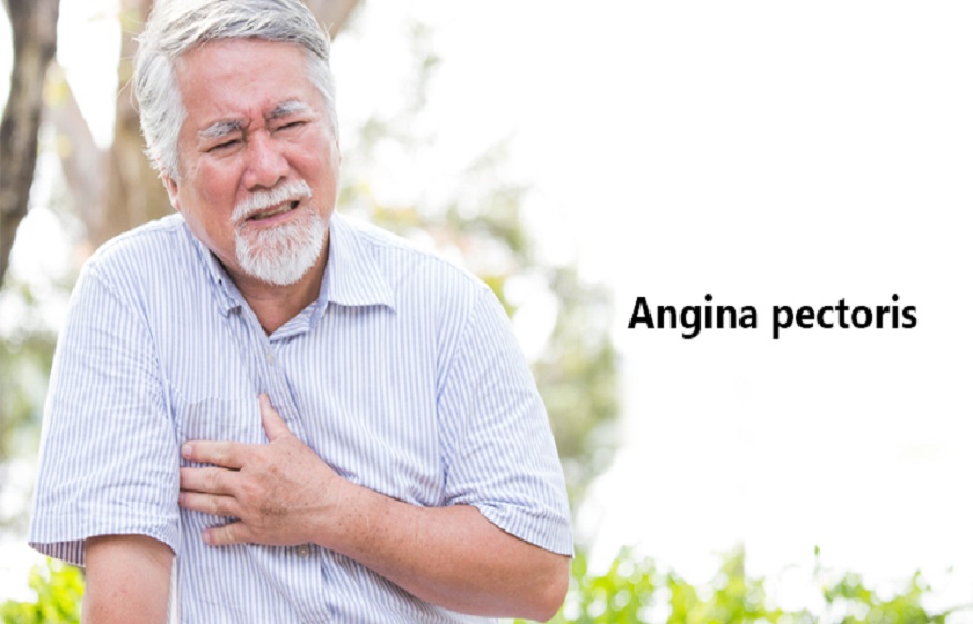 angina pectoris and Types of angina pectoris – TheLys