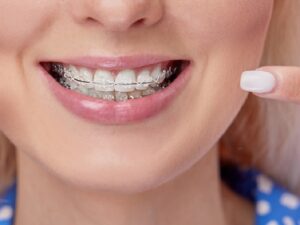 orthodontic
