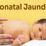 jaundice in newborns